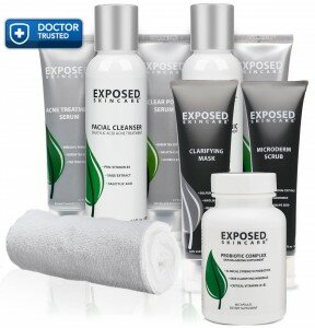 Exposed Acne Treatment